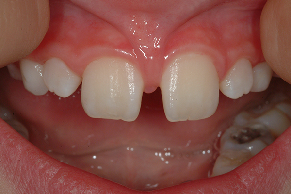 Before